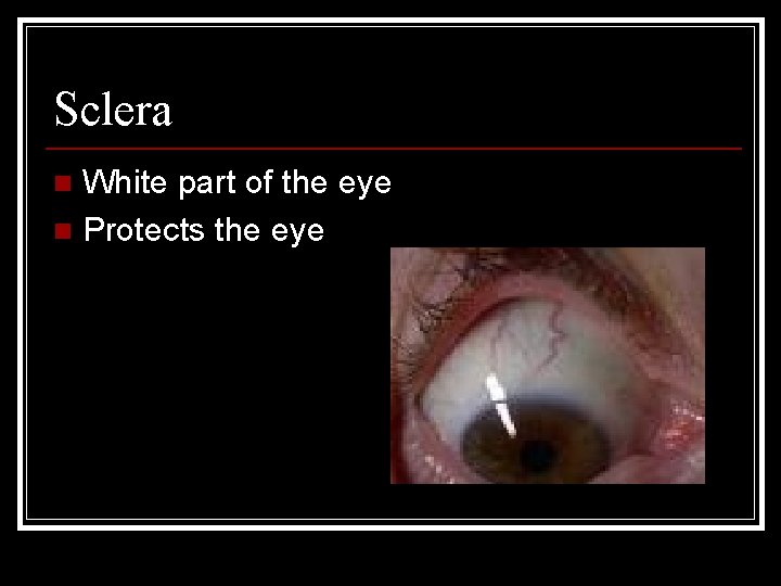 Sclera White part of the eye n Protects the eye n 