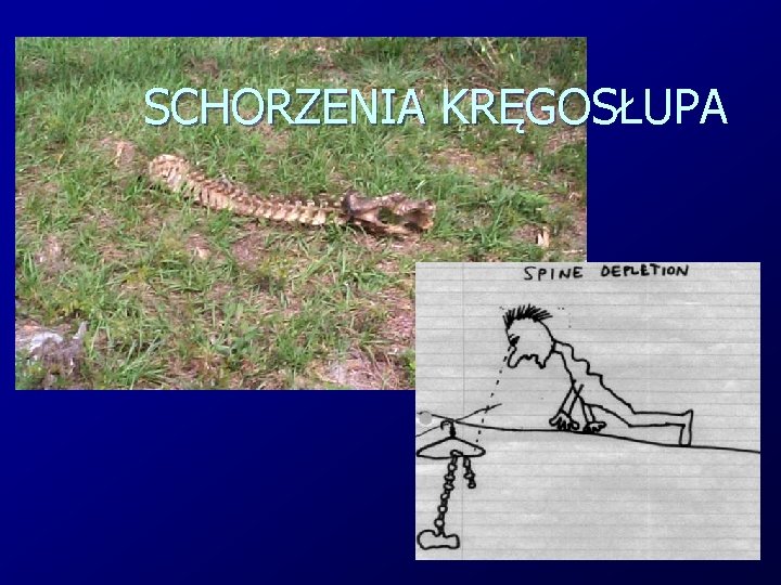 SCHORZENIA KRĘGOSŁUPA 