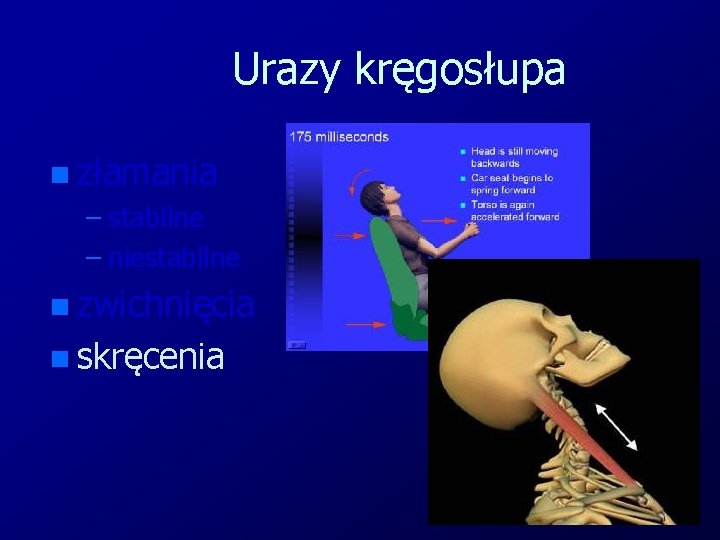 Urazy kręgosłupa n złamania – stabilne – niestabilne n zwichnięcia n skręcenia 