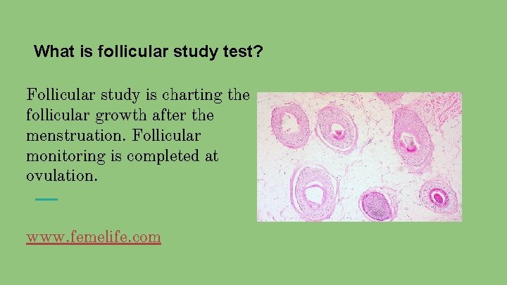 What is follicular study test? Follicular study is charting the follicular growth after the