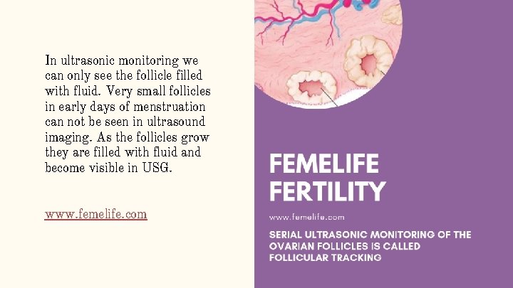 In ultrasonic monitoring we can only see the follicle filled with fluid. Very small