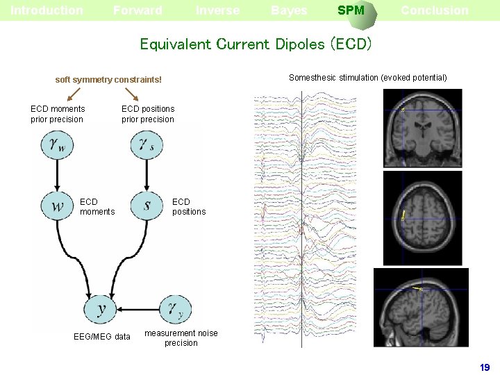 Introduction Forward Inverse Bayes SPM Conclusion Equivalent Current Dipoles (ECD) Somesthesic stimulation (evoked potential)