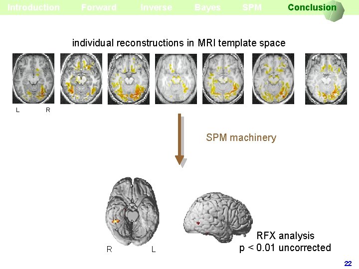 Introduction Forward Inverse Bayes SPM Conclusion individual reconstructions in MRI template space L R