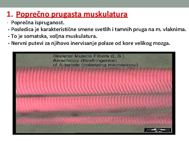 1. Poprečno prugasta muskulatura - Poprečna ispruganost. - Posledica je karakteristične smene svetlih i