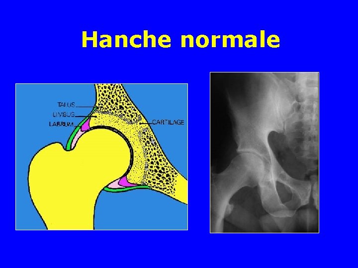 Hanche normale 