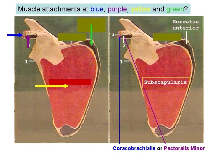Muscle attachments at blue, purple, yellow and green? Coracobrachialis or Pectoralis Minor 