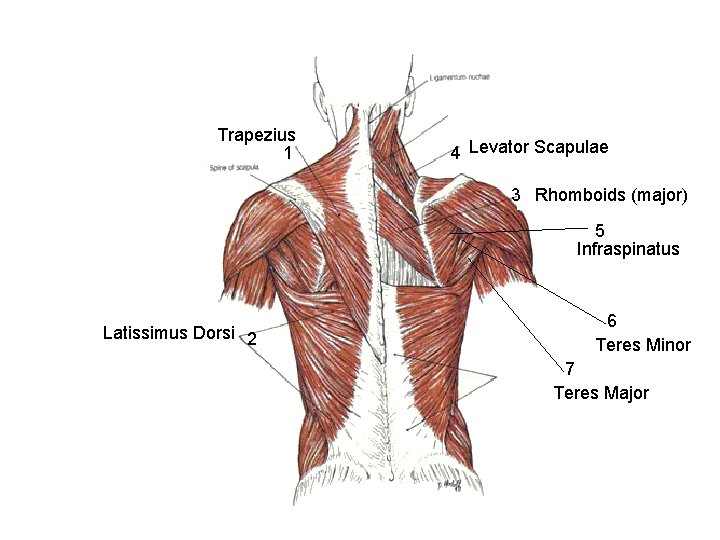 Trapezius 1 4 Levator Scapulae 3 Rhomboids (major) 5 Infraspinatus Latissimus Dorsi 2 6