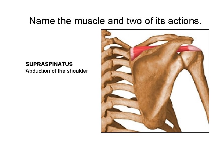 Name the muscle and two of its actions. SUPRASPINATUS Abduction of the shoulder 