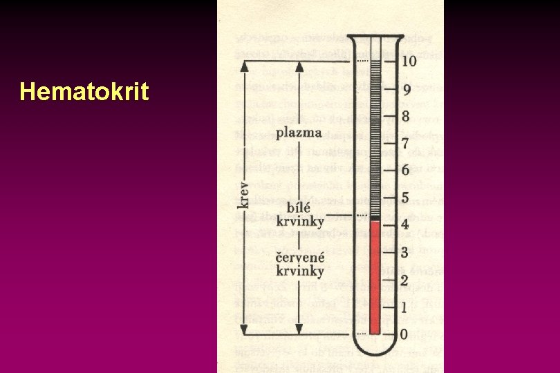 Hematokrit 