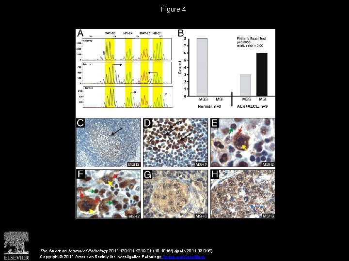 Figure 4 The American Journal of Pathology 2011 179411 -421 DOI: (10. 1016/j. ajpath.