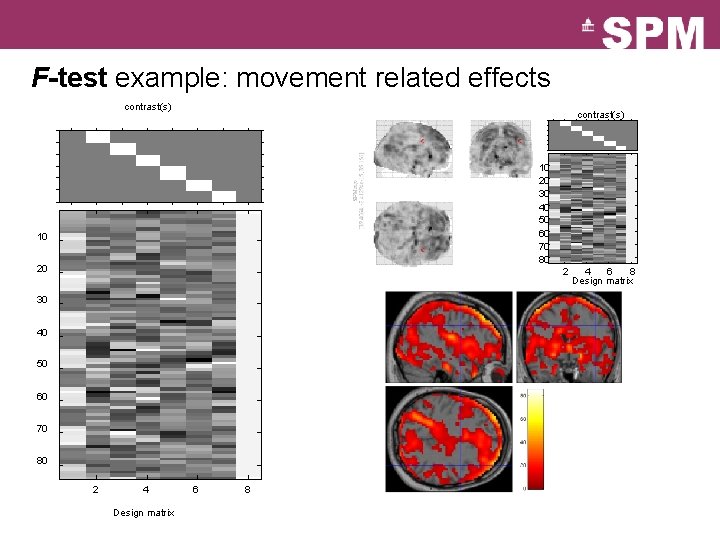 F-test example: movement related effects contrast(s) 10 20 30 40 50 60 70 80