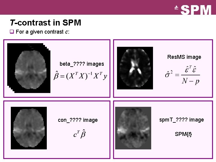 T-contrast in SPM q For a given contrast c: Res. MS image beta_? ?