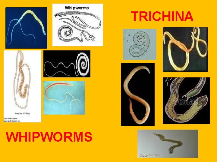 TRICHINA WHIPWORMS TRICHINA WHIPWORMS
