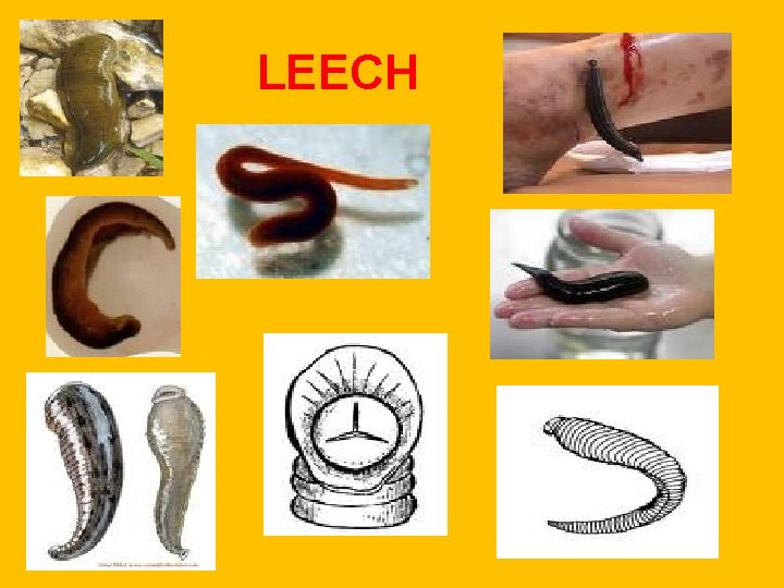 LEECH LEECH