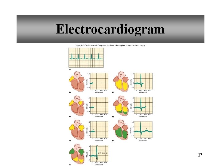 Electrocardiogram 27 