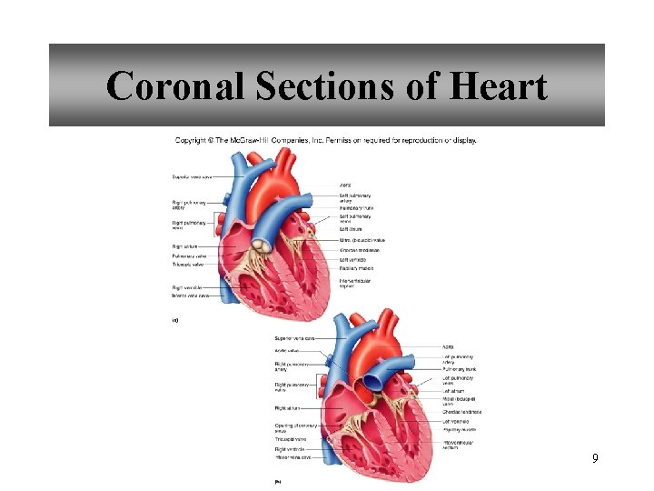 Coronal Sections of Heart 9 