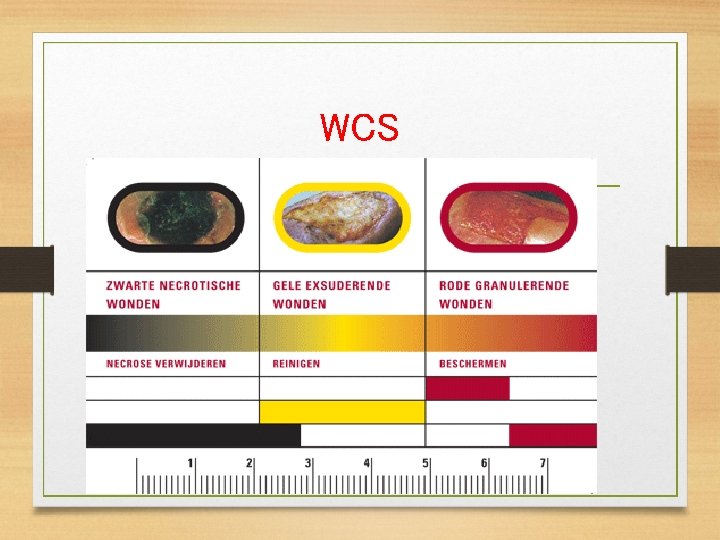 WCS Classificatie model 