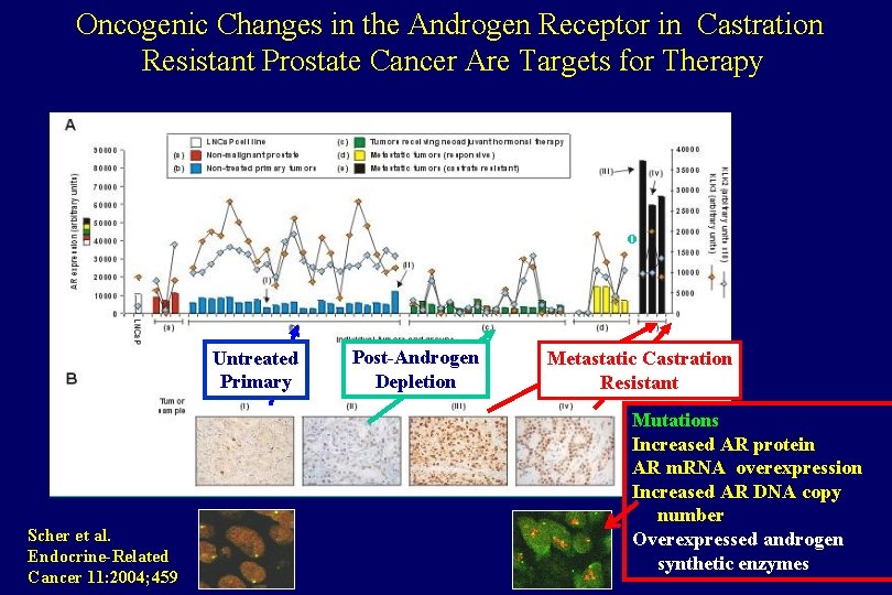 Oncogenic Changes in the Androgen Receptor in Castration Resistant Prostate Cancer Are Targets for