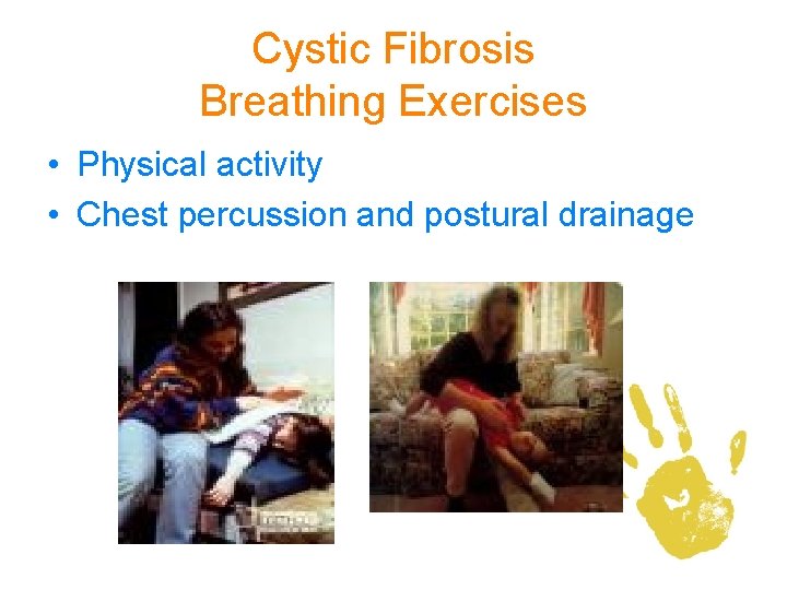 Cystic Fibrosis Breathing Exercises • Physical activity • Chest percussion and postural drainage 