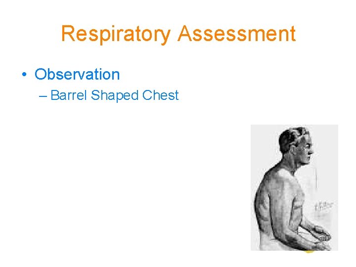 Respiratory Assessment • Observation – Barrel Shaped Chest 