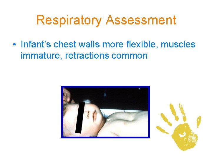 Respiratory Assessment • Infant’s chest walls more flexible, muscles immature, retractions common 