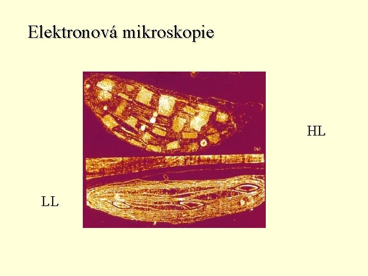 Elektronová mikroskopie HL LL 