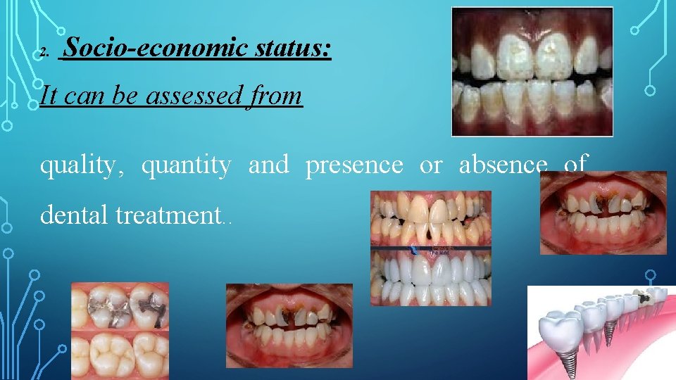 2. Socio-economic status: It can be assessed from quality, quantity and presence or absence