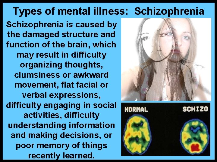 Types of mental illness: Schizophrenia is caused by the damaged structure and function of