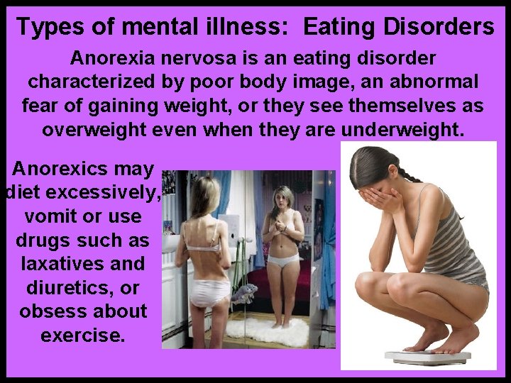 Types of mental illness: Eating Disorders Anorexia nervosa is an eating disorder characterized by