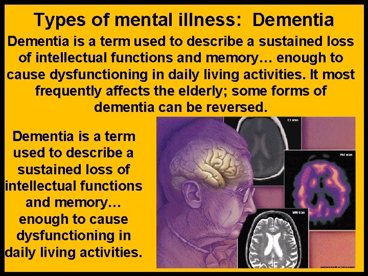 Types of mental illness: Dementia is a term used to describe a sustained loss