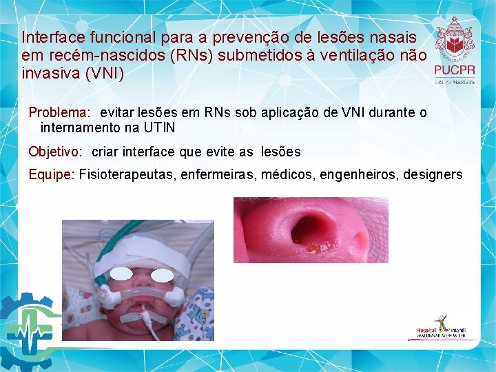 Interface funcional para a prevenção de lesões nasais em recém nascidos (RNs) submetidos à Interface funcional para a prevenção de lesões nasais em recém nascidos (RNs) submetidos à