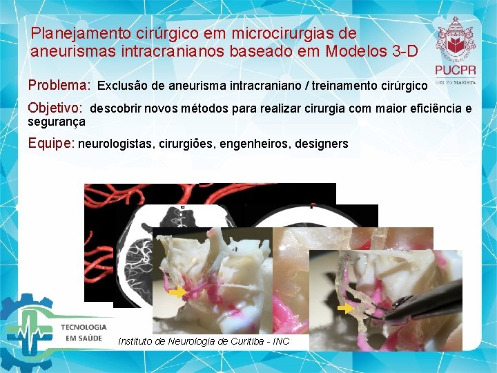 Planejamento cirúrgico em microcirurgias de aneurismas intracranianos baseado em Modelos 3 D Problema: Exclusão Planejamento cirúrgico em microcirurgias de aneurismas intracranianos baseado em Modelos 3 D Problema: Exclusão