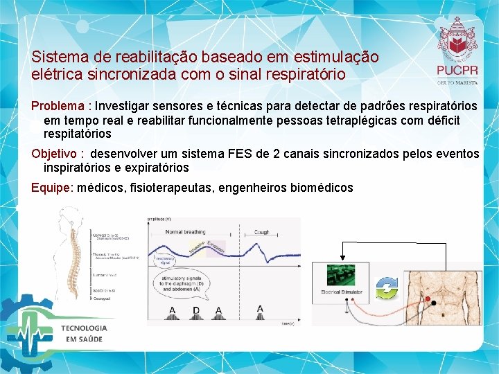 Sistema de reabilitação baseado em estimulação elétrica sincronizada com o sinal respiratório Problema : Sistema de reabilitação baseado em estimulação elétrica sincronizada com o sinal respiratório Problema :