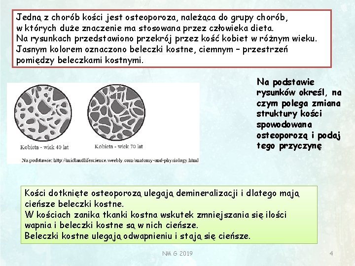 Jedną z chorób kości jest osteoporoza, należąca do grupy chorób, w których duże znaczenie