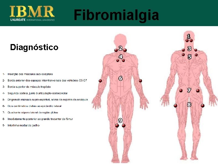 Fibromialgia Diagnóstico 
