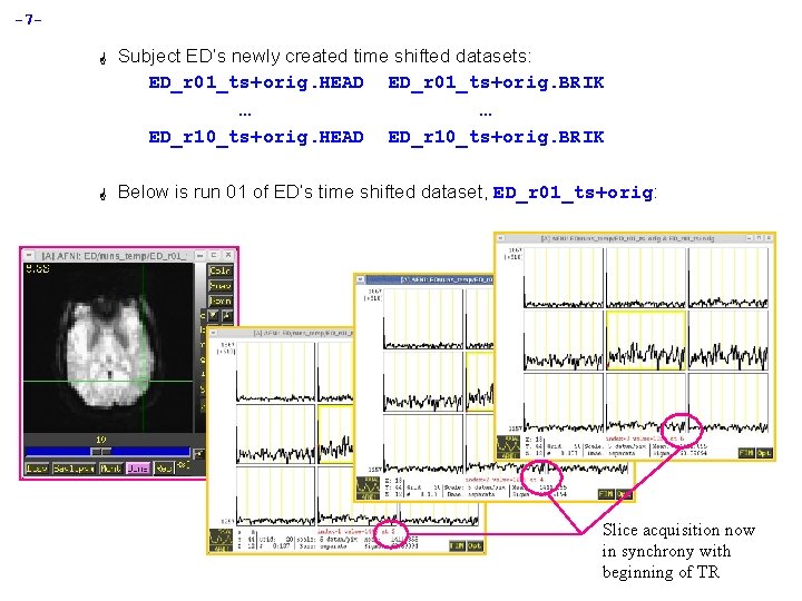 -7 G Subject ED’s newly created time shifted datasets: ED_r 01_ts+orig. HEAD ED_r 01_ts+orig.