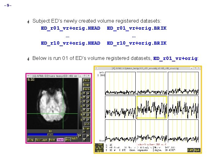 -9 - G Subject ED’s newly created volume registered datasets: ED_r 01_vr+orig. HEAD ED_r