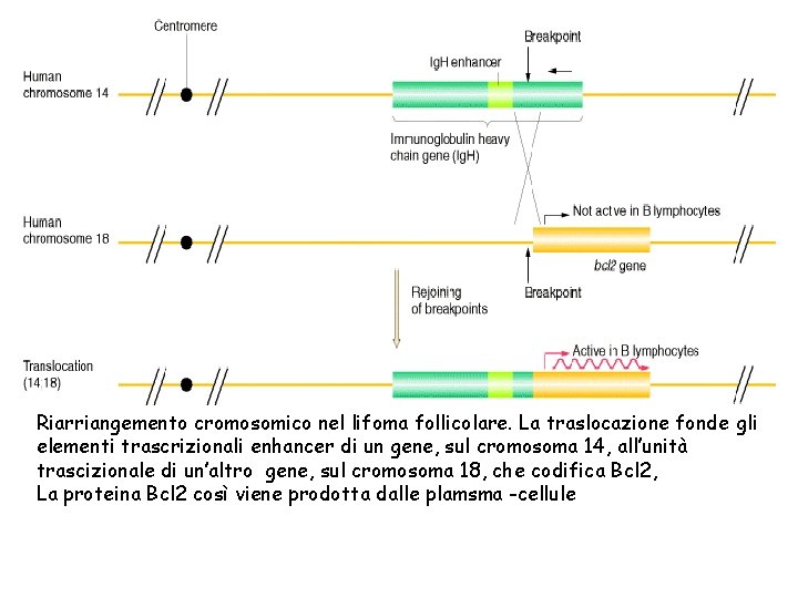 Riarriangemento cromosomico nel lifoma follicolare. La traslocazione fonde gli elementi trascrizionali enhancer di un