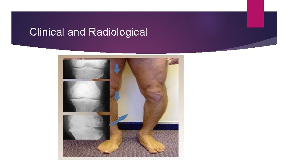 Clinical and Radiological 