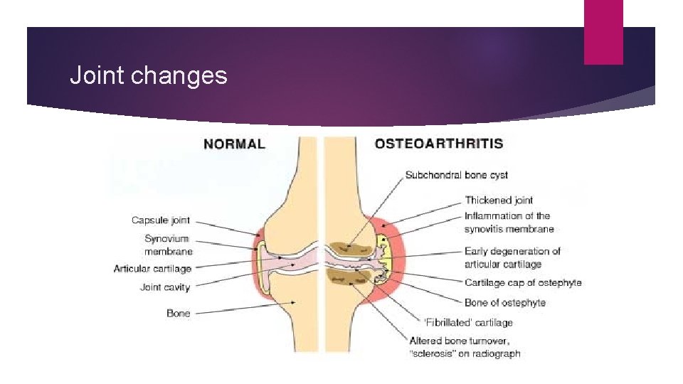 Joint changes 