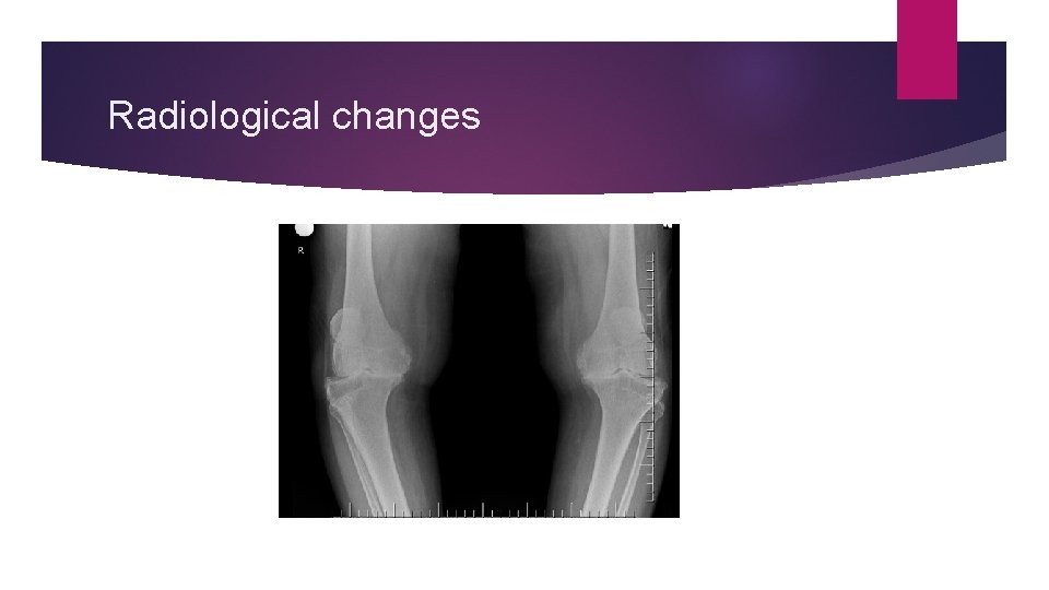 Radiological changes 