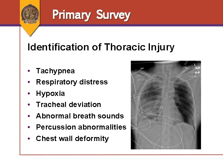 Primary Survey Identification of Thoracic Injury • • Tachypnea Respiratory distress Hypoxia Tracheal deviation Primary Survey Identification of Thoracic Injury • • Tachypnea Respiratory distress Hypoxia Tracheal deviation