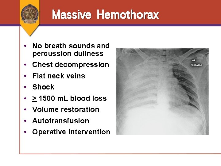 Massive Hemothorax • No breath sounds and percussion dullness • Chest decompression • Flat Massive Hemothorax • No breath sounds and percussion dullness • Chest decompression • Flat