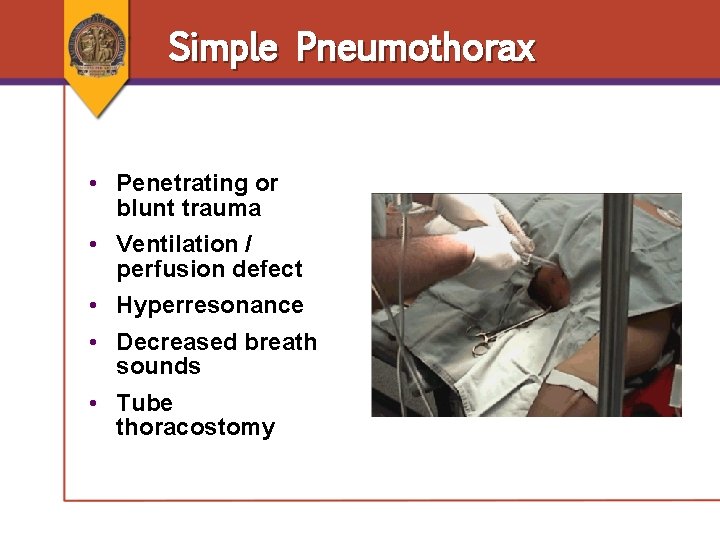 Simple Pneumothorax • Penetrating or blunt trauma • Ventilation / perfusion defect • Hyperresonance Simple Pneumothorax • Penetrating or blunt trauma • Ventilation / perfusion defect • Hyperresonance