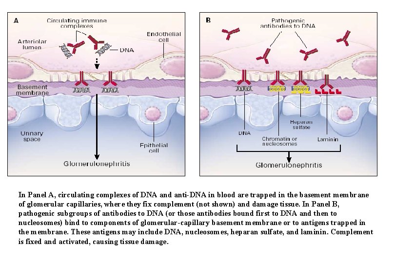 In Panel A, circulating complexes of DNA and anti-DNA in blood are trapped in