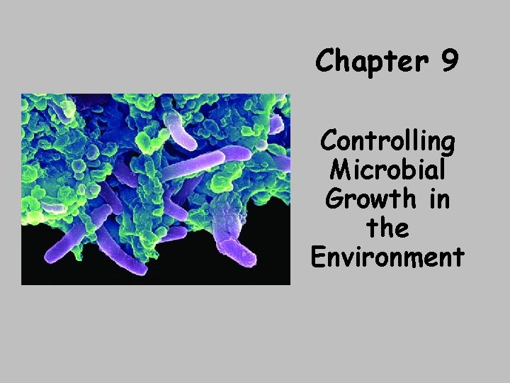 Chapter 9 Controlling Microbial Growth in the Environment 