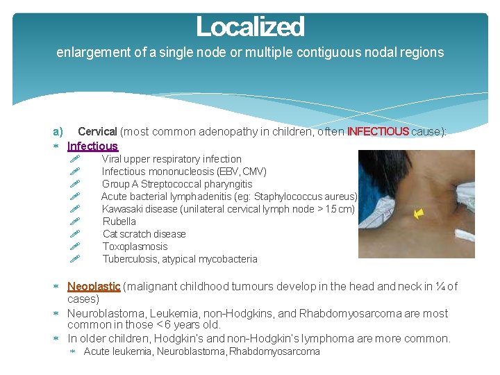 Localized enlargement of a single node or multiple contiguous nodal regions a) Cervical (most Localized enlargement of a single node or multiple contiguous nodal regions a) Cervical (most