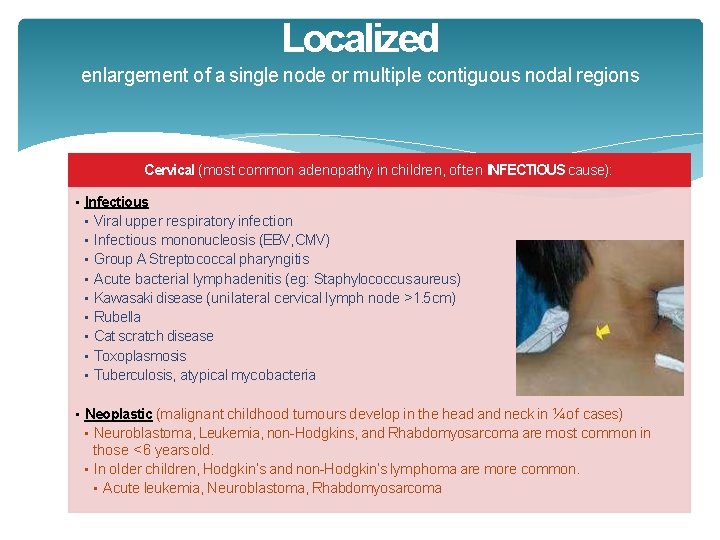 Localized enlargement of a single node or multiple contiguous nodal regions Cervical (most common Localized enlargement of a single node or multiple contiguous nodal regions Cervical (most common
