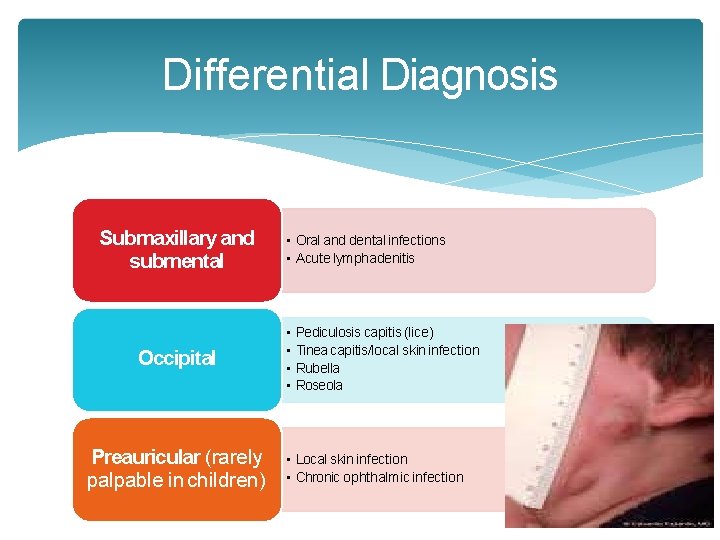 Differential Diagnosis Submaxillary and submental Occipital Preauricular (rarely palpable in children) • Oral and Differential Diagnosis Submaxillary and submental Occipital Preauricular (rarely palpable in children) • Oral and
