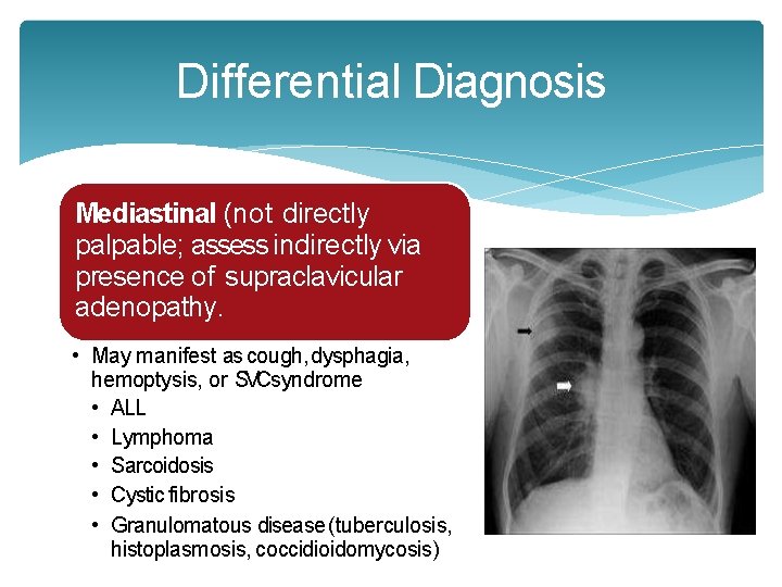 Differential Diagnosis Mediastinal (not directly palpable; assess indirectly via presence of supraclavicular adenopathy. • Differential Diagnosis Mediastinal (not directly palpable; assess indirectly via presence of supraclavicular adenopathy. •